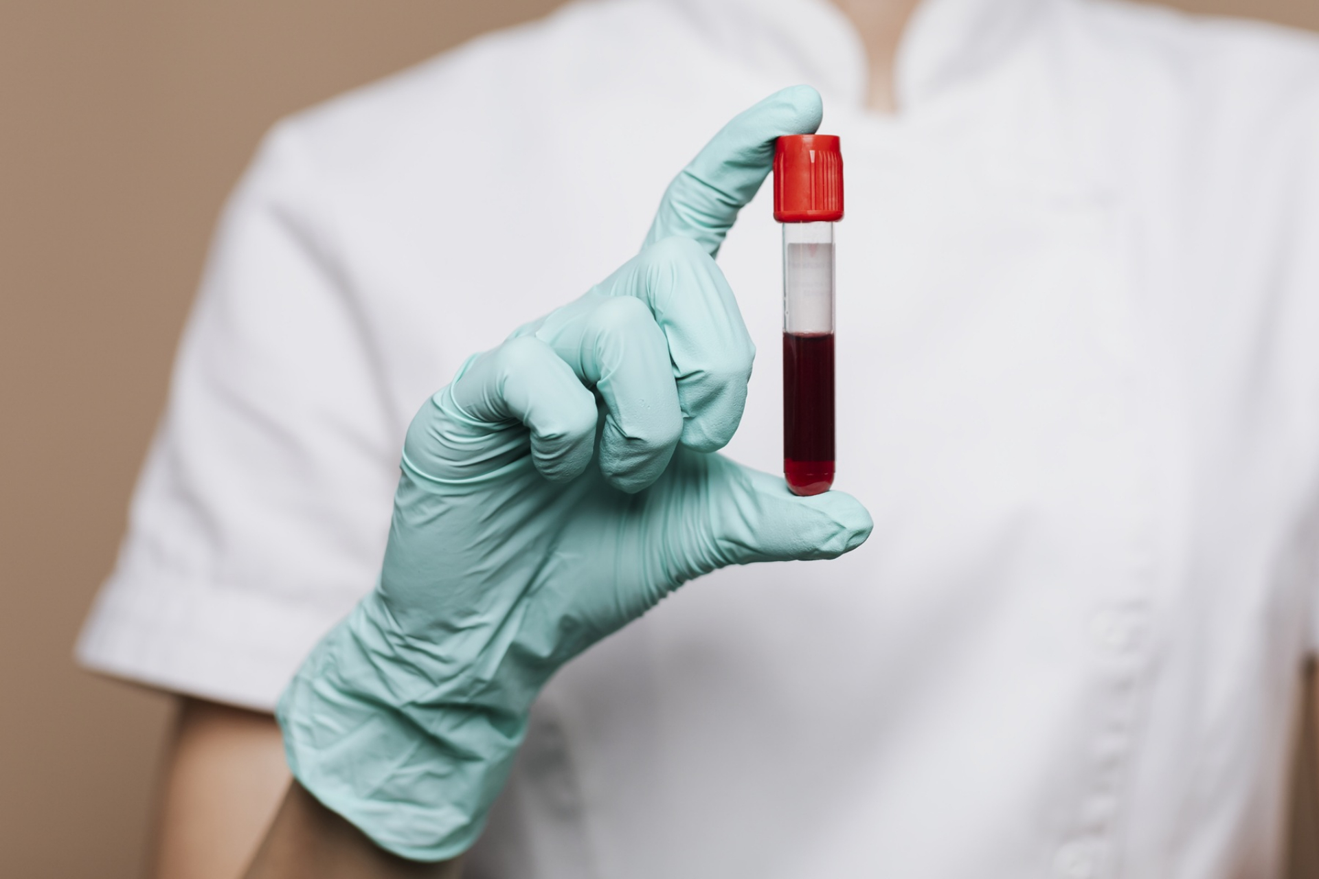mpv-blood-test-normal-range-what-is-considered-normal-high-or-low