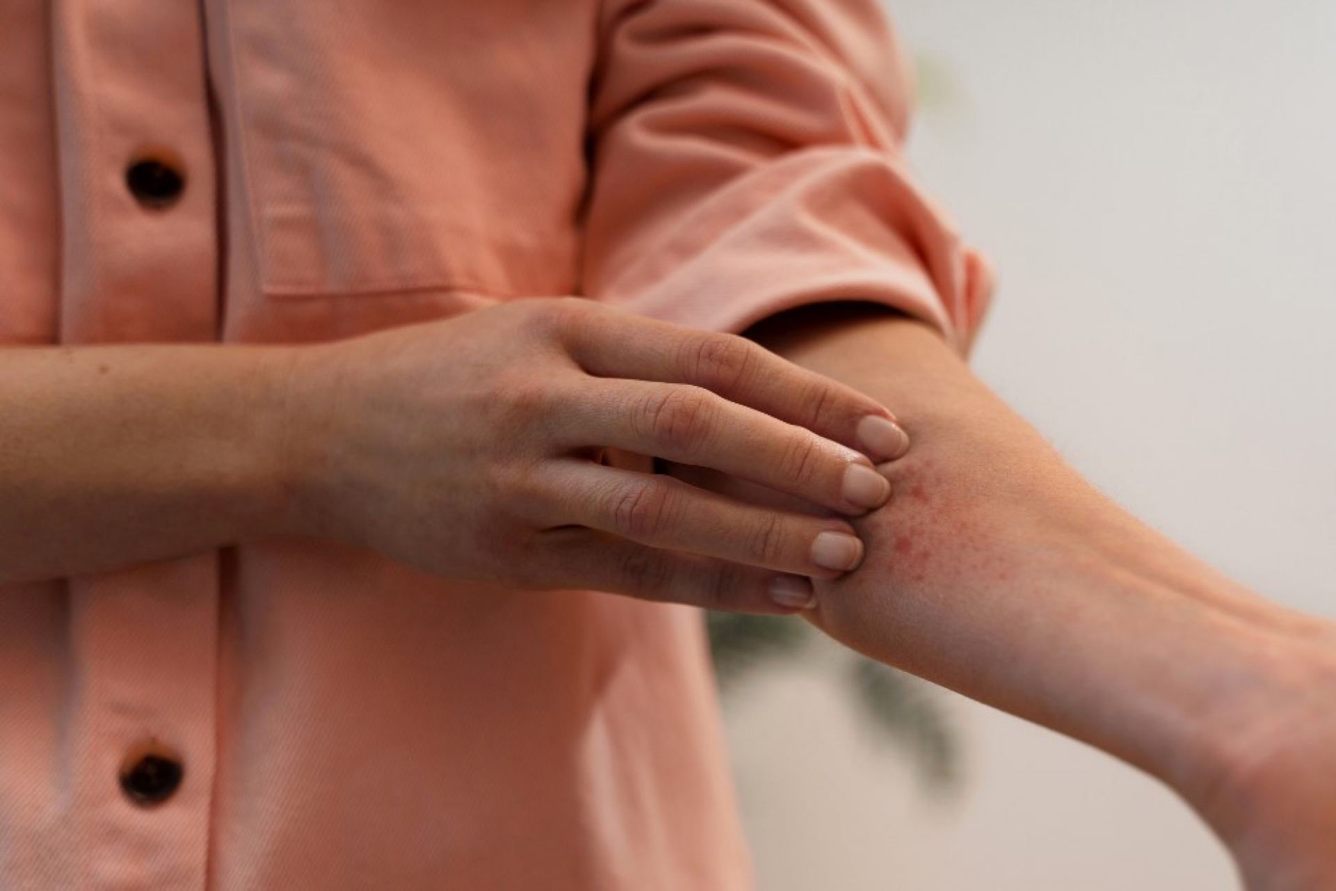 what-causes-winter-eczema-understanding-flares-triggers-and-the-role-of-ige-and-allergy-tests