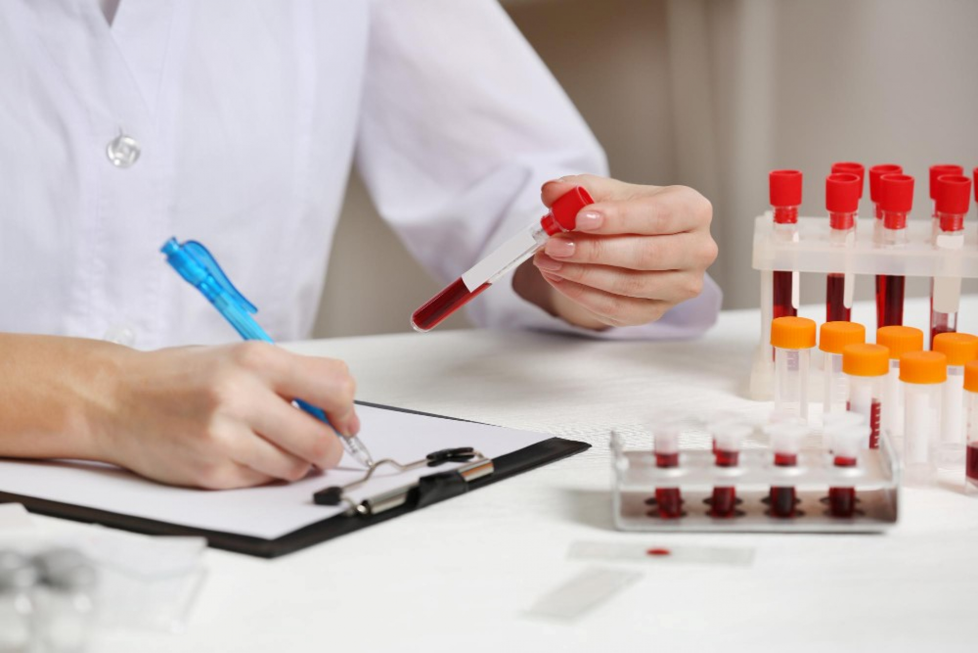 can-a-cbc-test-detect-infections-how-complete-blood-count-analysis-reveals-infection-markers