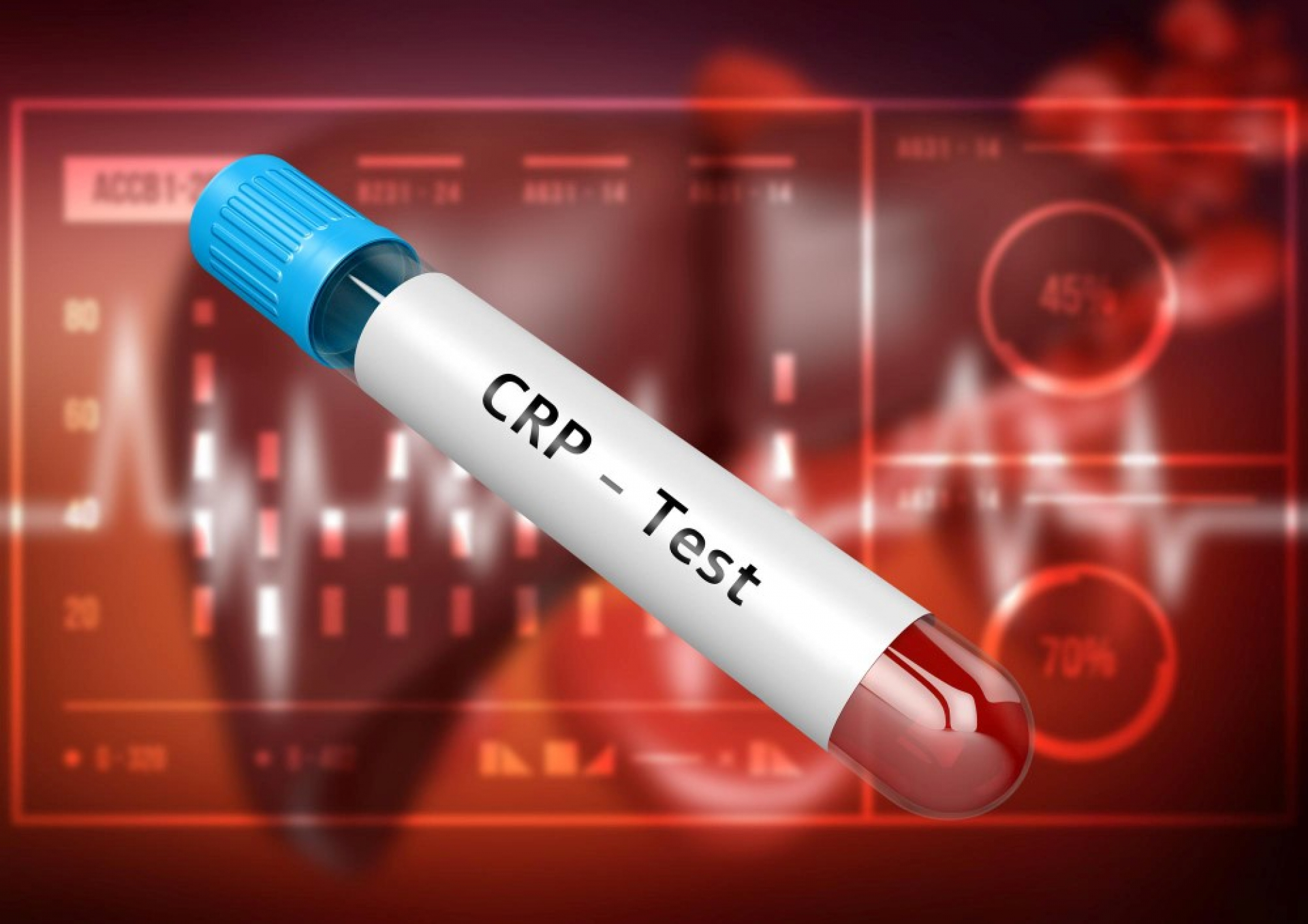 home-collection-for-crp-esr-when-it-is-suitable-vs-when-clinic-testing-is-better