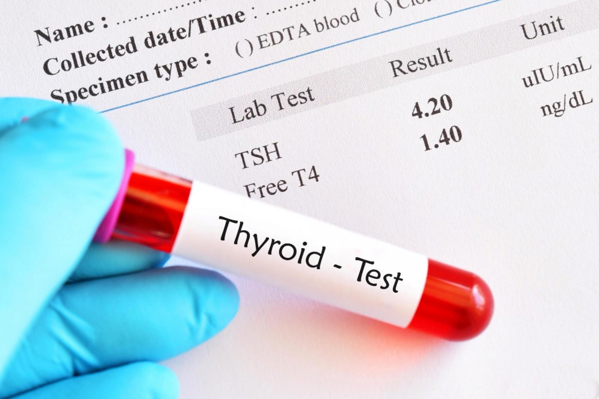 high-tsh-vs-low-tsh-a-clear-tsh-interpretation-guide-to-understand-abnormal-thyroid-results