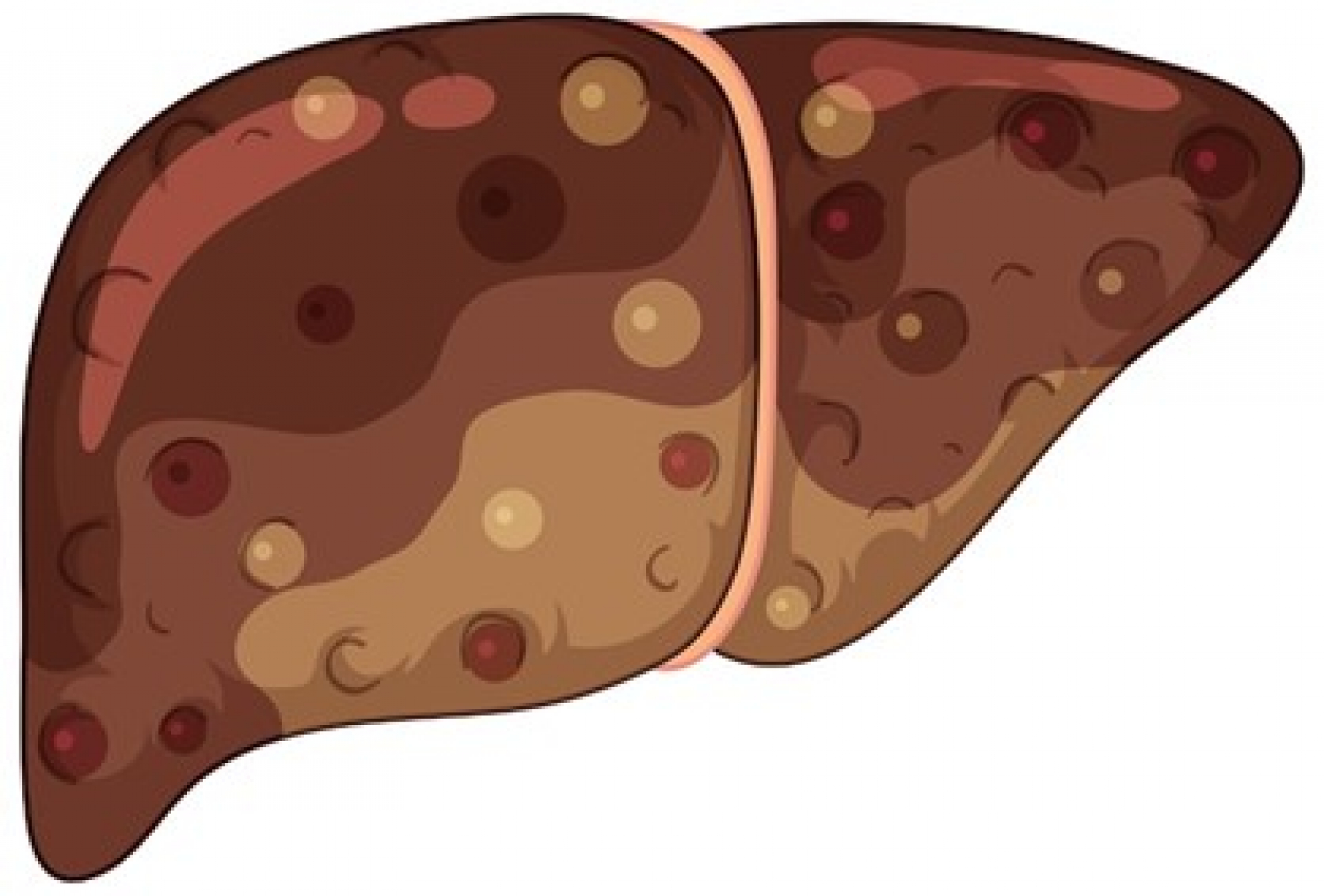 understanding-hepatitis-a-virus-igm-test-diagnosis-test-results-and-normal-range