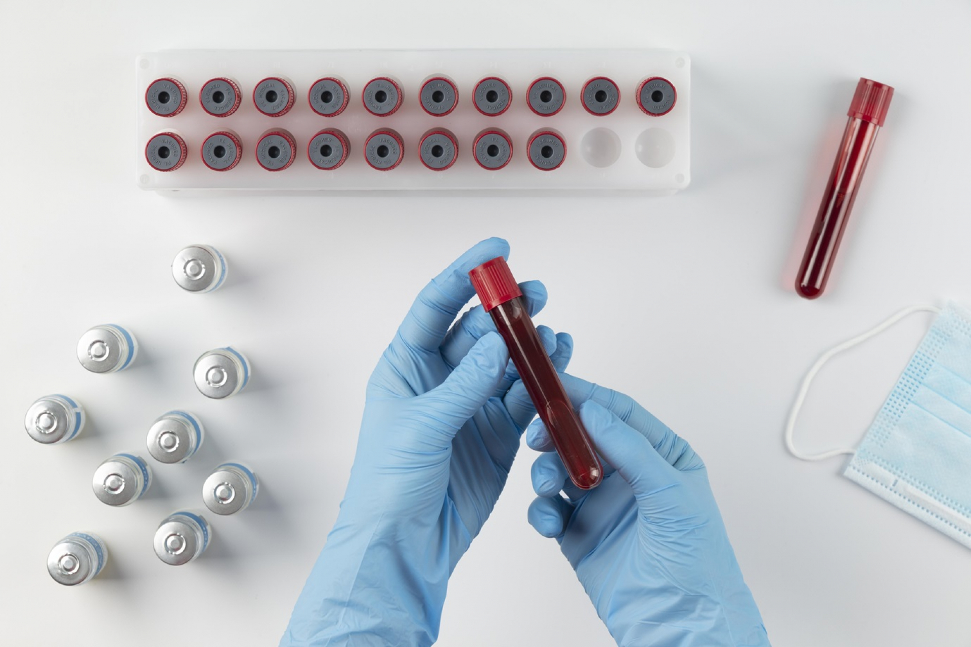 abnormal-hemoglobin-the-role-of-hb-electrophoresis